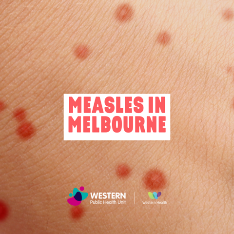 Have you had your measles vaccination?